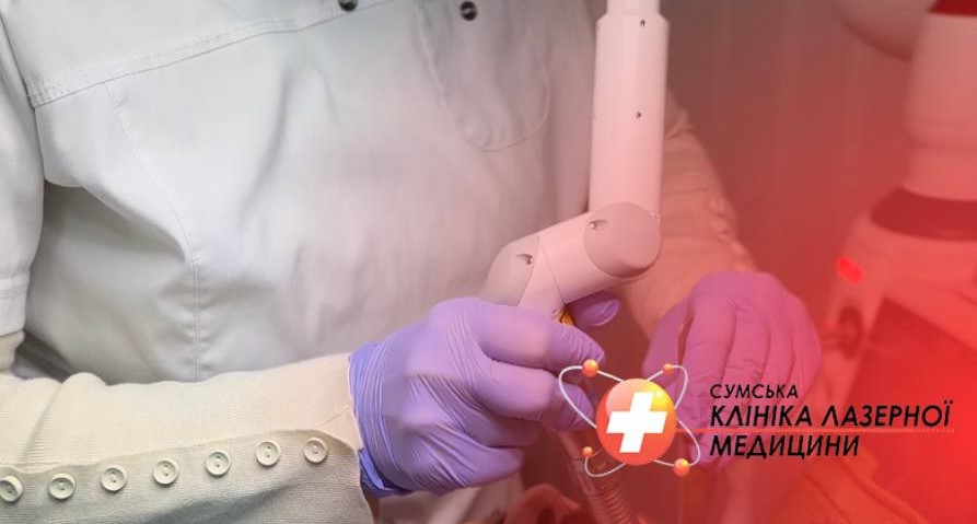 Laser Treatment for Snoring